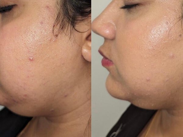 Lemon-Bottle-Before-After-6